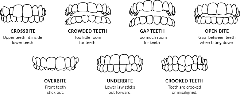 Invisalign Smile Assessment, Apple Dental Care